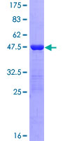 12.5% SDS-PAGE Stained with Coomassie Blue